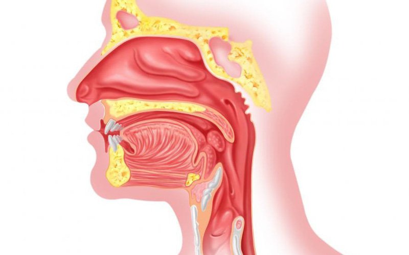 Các triệu chứng nổi bật của bệnh tai mũi họng là gì?
